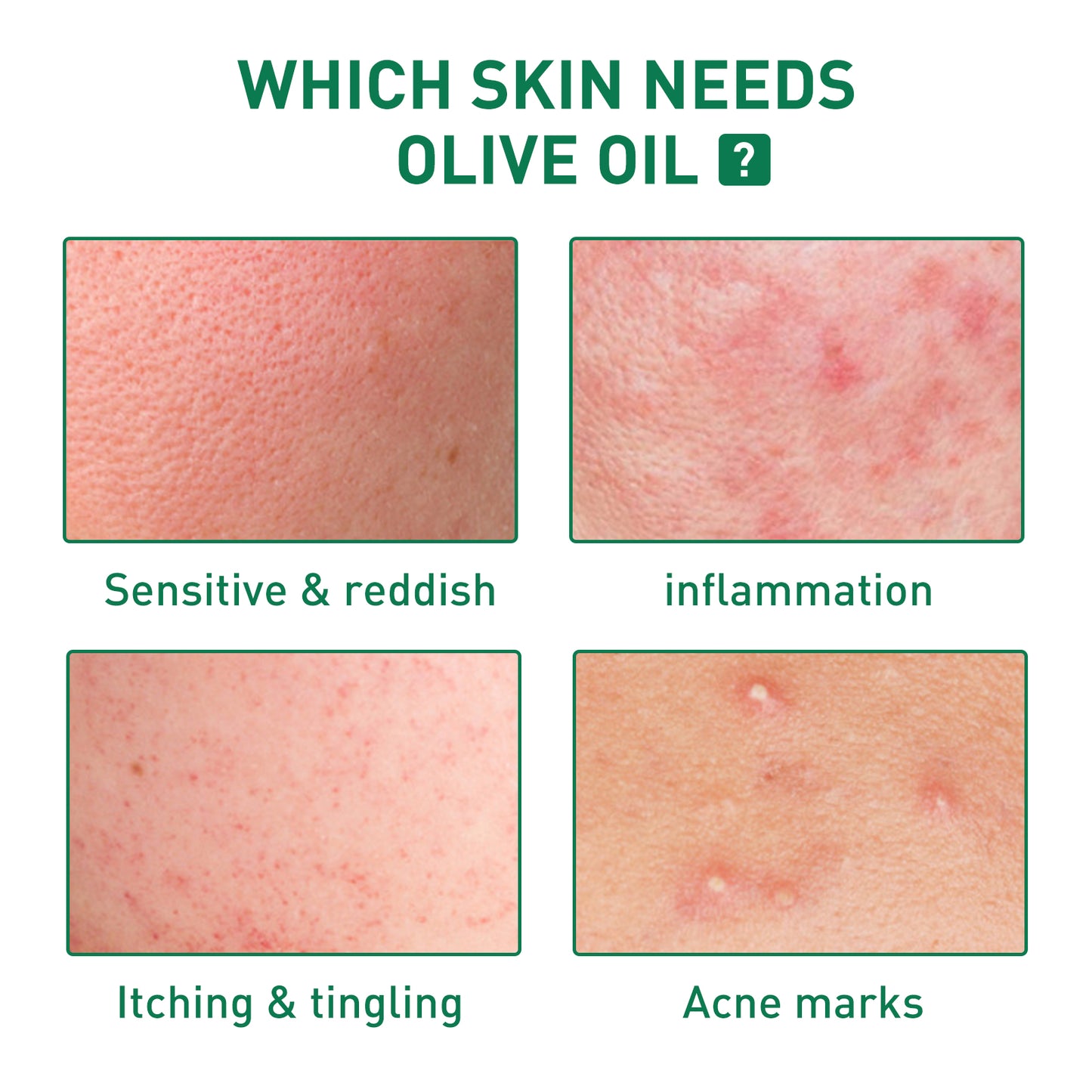 GlowVital™ Tea Tree Acne Repair Serum