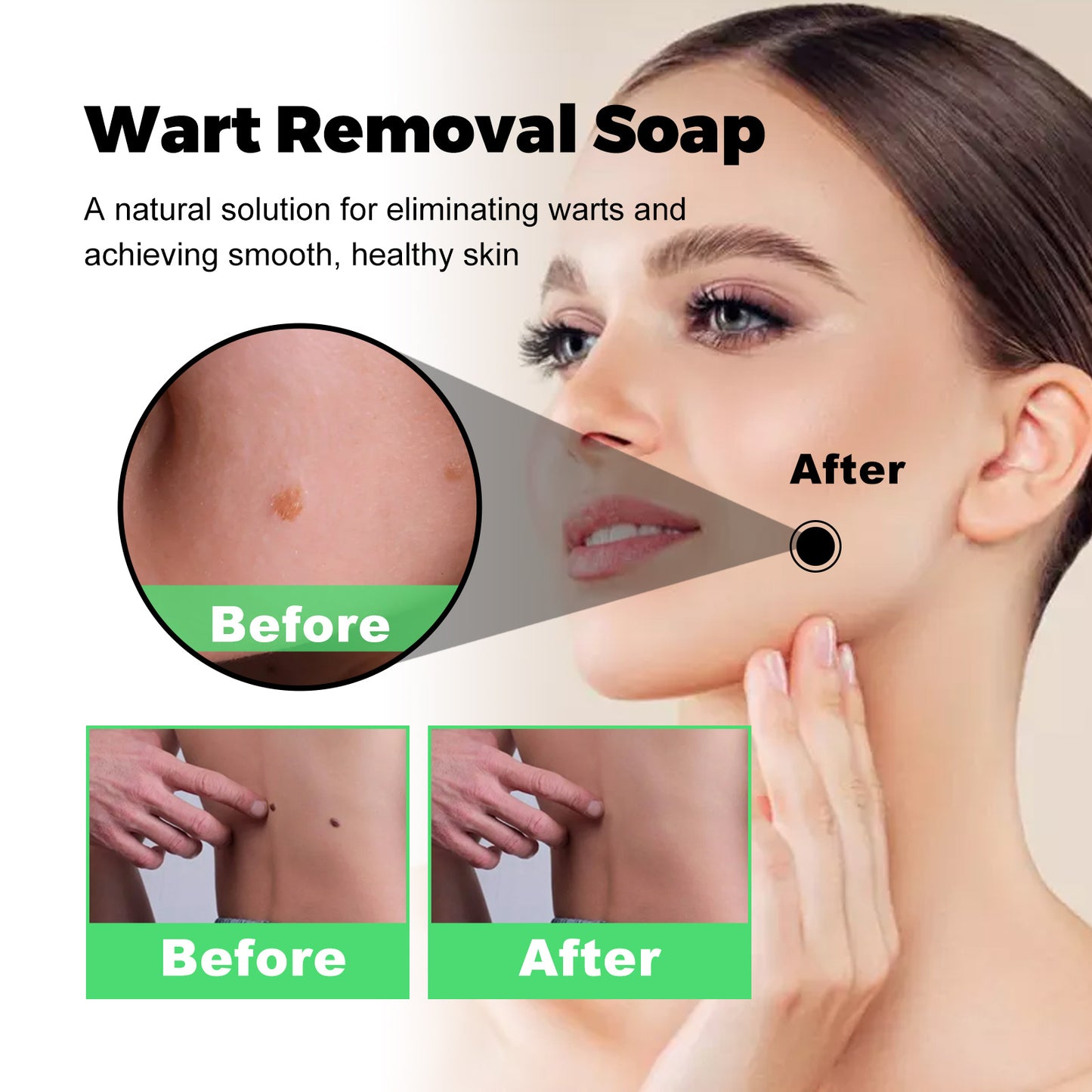 GlowVital™ Skin Tag & Mole Remover Kit