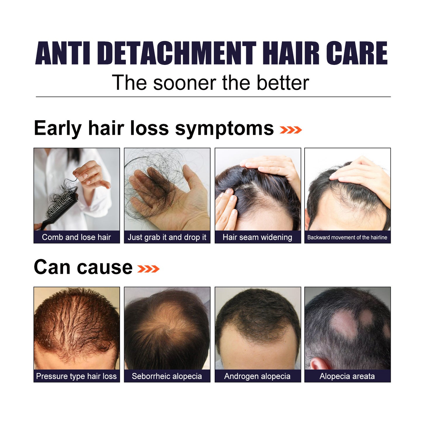 Herbal Hair Essence, Moisturizes Scalp Strong Hair Roots Thick Beard Care Essence