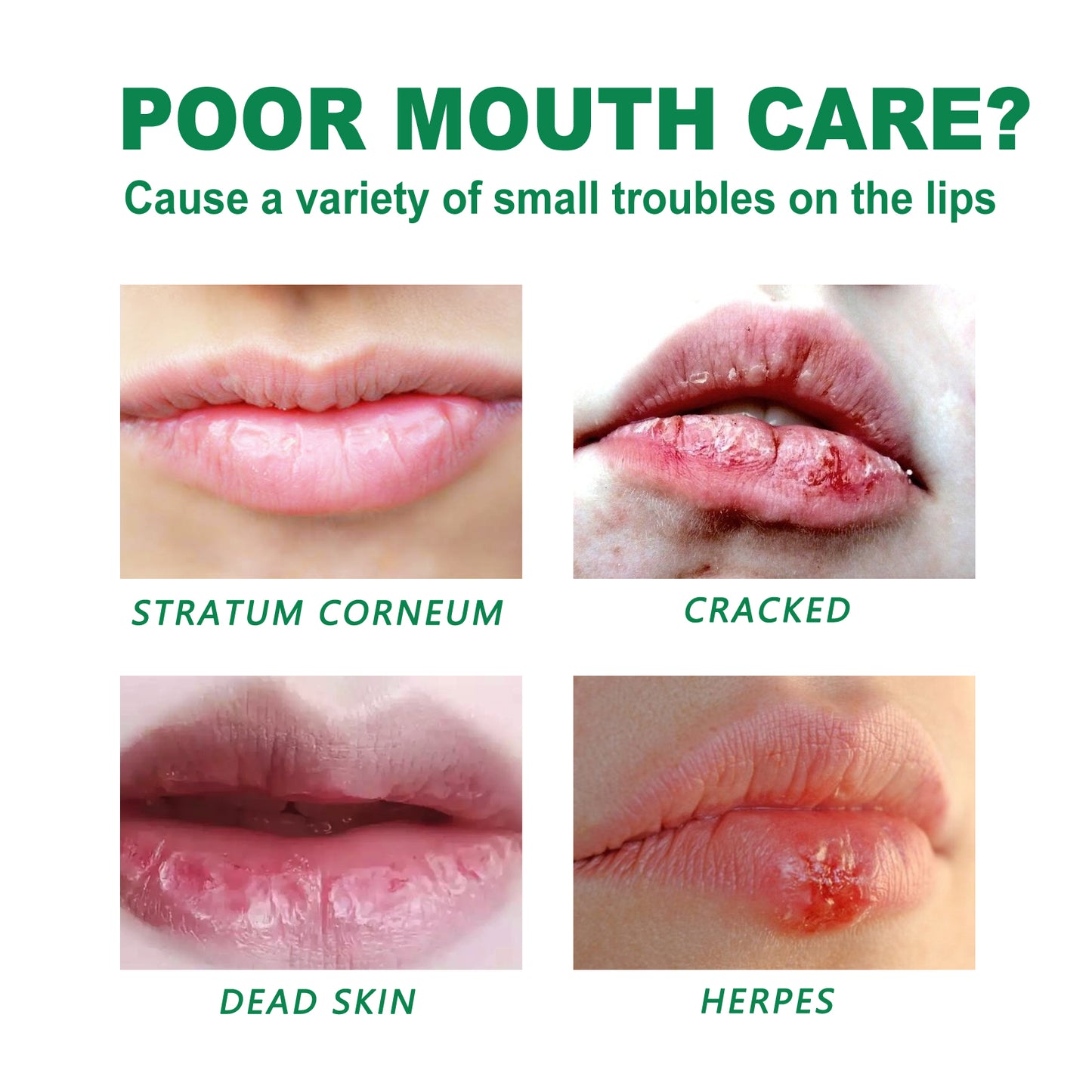 GlowVital™ Herbal Repair Lip Balm